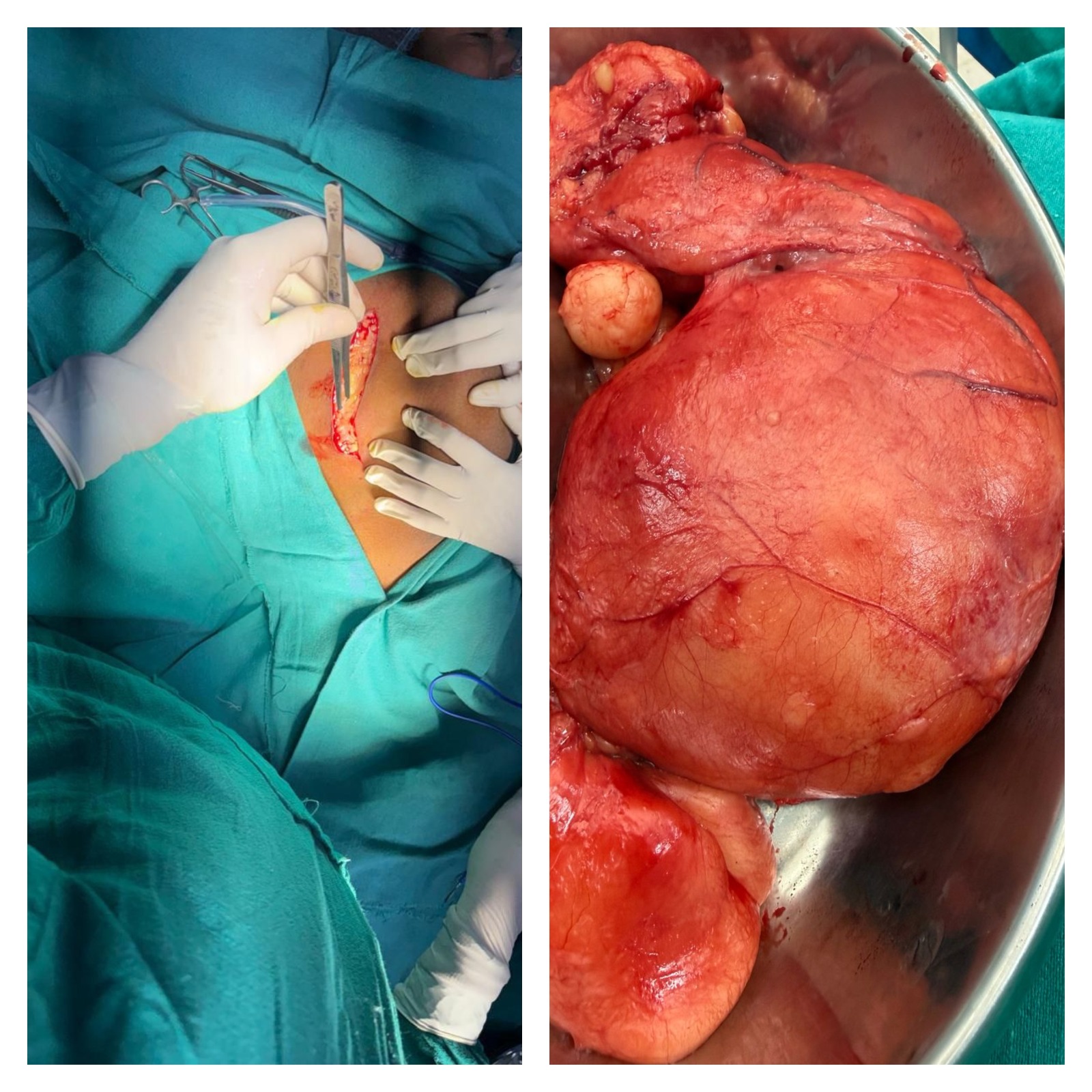 General Surgery at K.K. Medical College